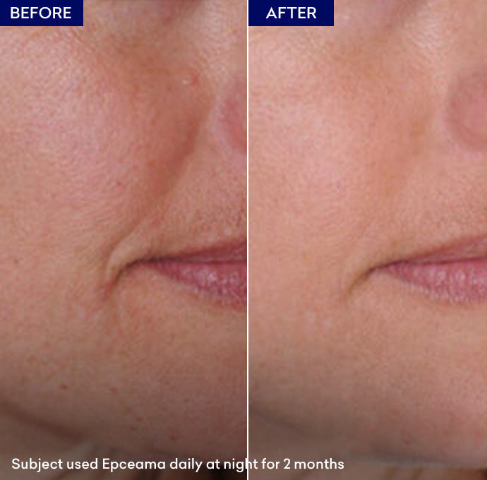 Epceama Anti Aging Serum