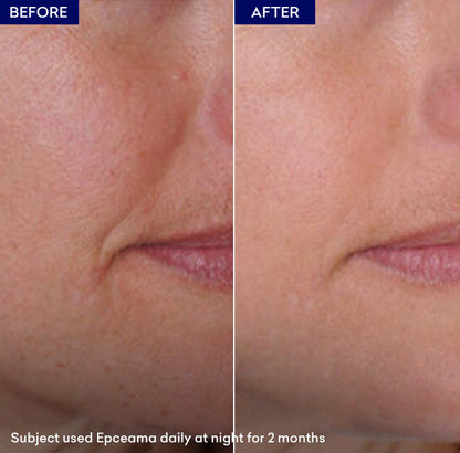 Epceama Anti Aging Serum