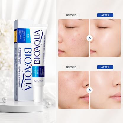BIOAQUA Anti-Acne & Rejuvenating Cream - Acne Care 30g