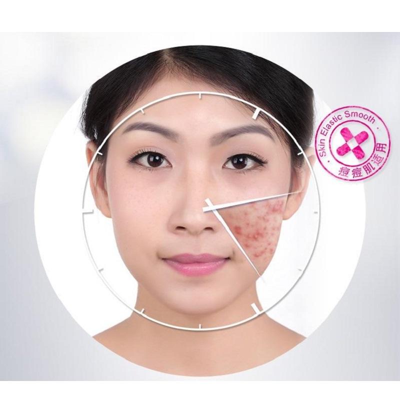 BIOAQUA Anti-Acne & Rejuvenating Cream - Acne Care 30g