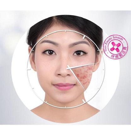 BIOAQUA Anti-Acne & Rejuvenating Cream - Acne Care 30g